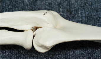 人体骨格模型の肘関節