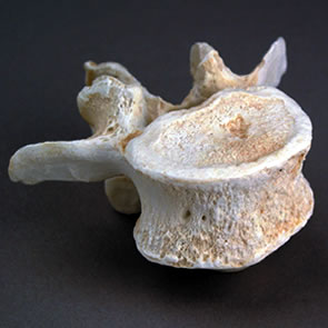 第3腰椎-前面の接写の様子