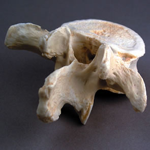 第3腰椎-背面の接写の様子