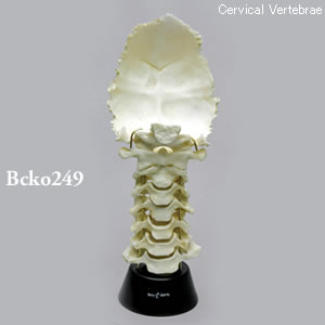 後頭骨付頸椎模型 BCKO249 Bone Clones ボーンクローン