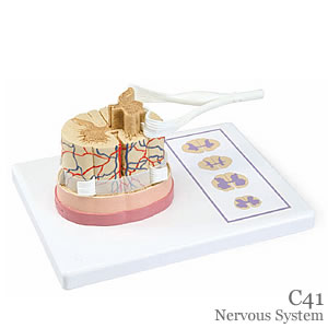 脊髄と脊髄神経根模型