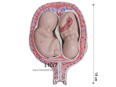 �D�P5�����o�����̎q�{�Ƒَ�