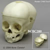 小児頭蓋骨模型　1才・頭蓋冠分離型