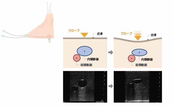 超音波ガイド下で穿刺のトレーニング